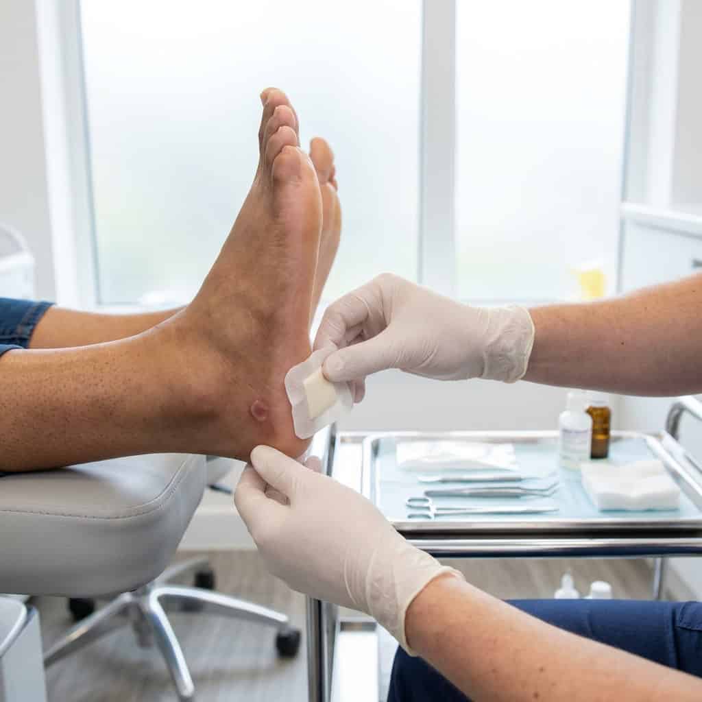 Blister care  in Ballymena